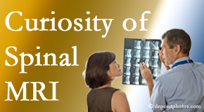 Millville MRIs for spinal stenosis may be revealing…or confusing.