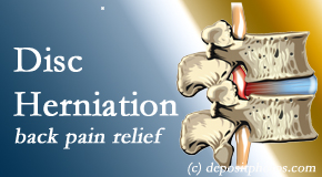 Wilson Family Chiropractic uses non-surgical treatment for relief of disc herniation related back pain. 