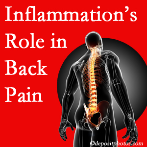 The role of inflammation in Millville back pain is real. Chiropractic care can help.