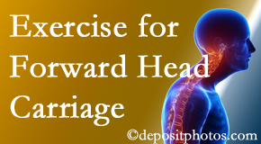 Millville chiropractic treatment of forward head carriage is two-fold: manipulation and exercise.