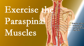 Wilson Family Chiropractic describes the importance of paraspinal muscles and their strength for Millville back pain relief.