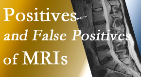 Wilson Family Chiropractic carefully chooses when and if MRI images are needed to guide the Millville chiropractic treatment plan. 