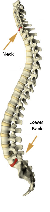 neck disc pain spine picture