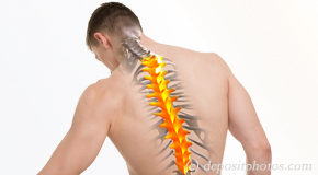 Millville thoracic spine pain image 