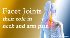 Wilson Family Chiropractic carefully examines, diagnoses, and treats cervical spine facet joints for neck pain relief when they are involved.