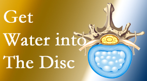 Wilson Family Chiropractic uses spinal manipulation and exercise to enhance the diffusion of water into the disc which helps the health of the disc.