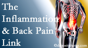 Wilson Family Chiropractic addresses the inflammatory process that accompanies back pain as well as the pain itself.