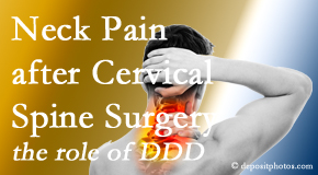Wilson Family Chiropractic offers gentle treatment for neck pain after neck surgery.