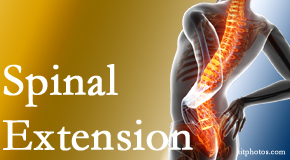 Wilson Family Chiropractic understands the role of extension in spinal motion, its necessity, its benefits and potential harmful effects. 
