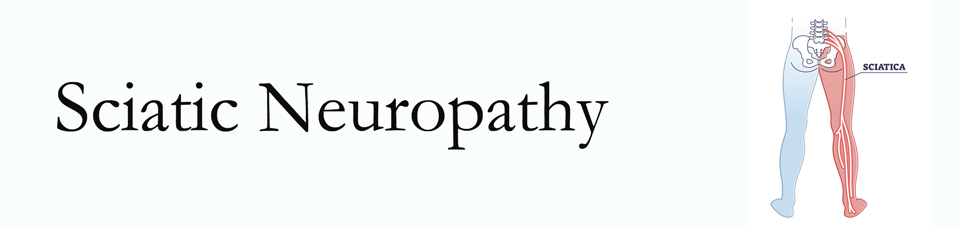 Millville neuropathy pain (sciatica) 