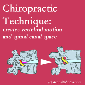 picture of a Millville spinal stenotic canal