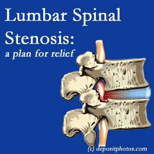 picture of Millville lumbar spinal stenosis 