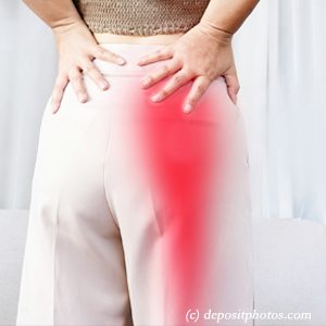 picture of Millville leg pain, sciatica, lumbar radiculopathy