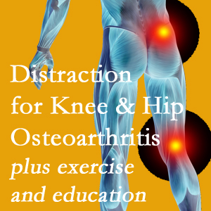A chiropractic treatment plan for Millville knee pain and hip pain caused by osteoarthritis: education, exercise, distraction.