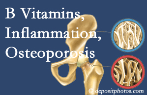 Millville chiropractic care of osteoporosis often comes with nutritional tips like b vitamins for inflammation reduction and for prevention.
