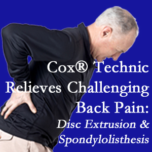 Millville chiropractic care with Cox Technic relieves back pain due to a painful combination of a disc extrusion and a spondylolytic spondylolisthesis.